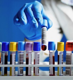 Медицинские анализы